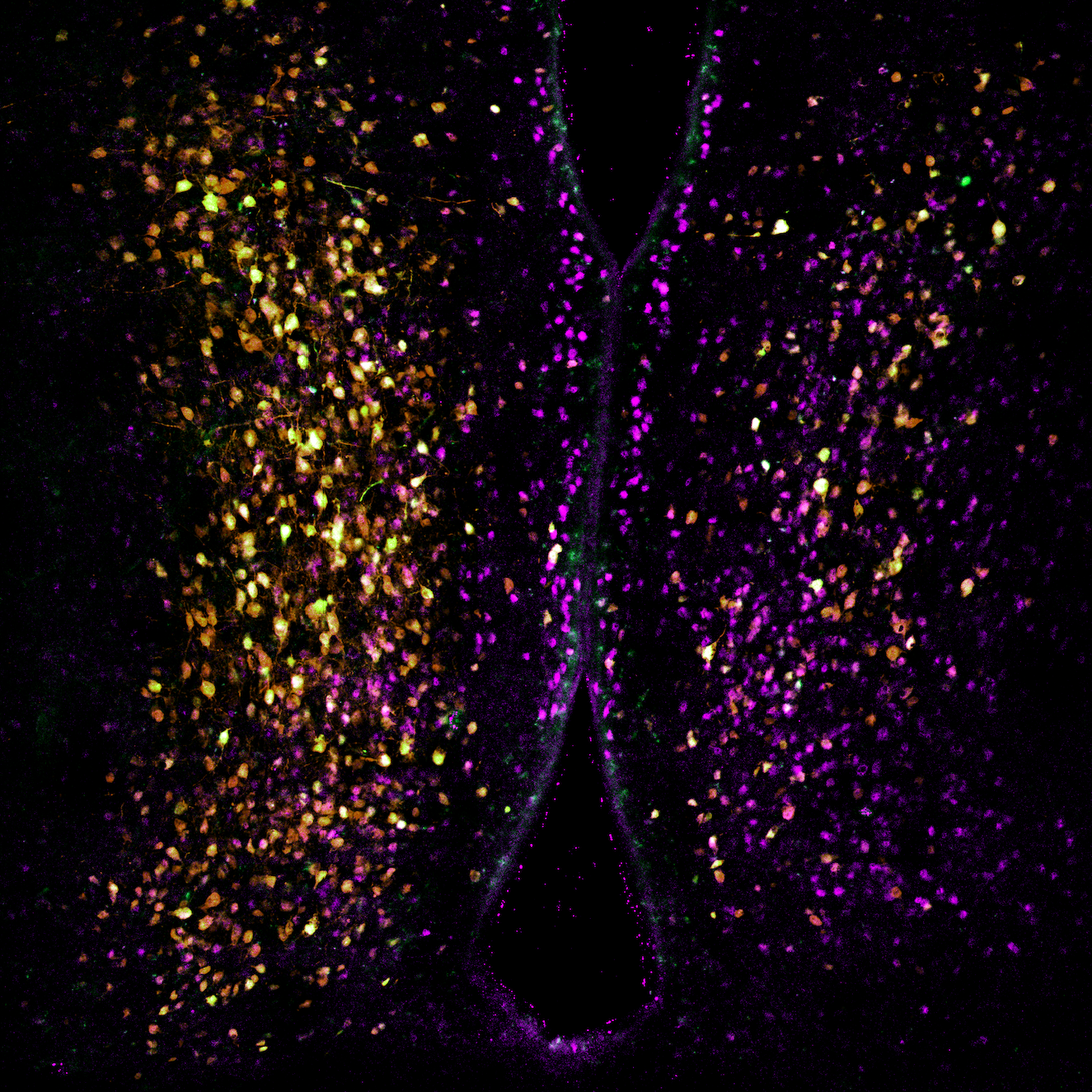 Fluorescence microscopy image accompanying the neuro-seeER paper